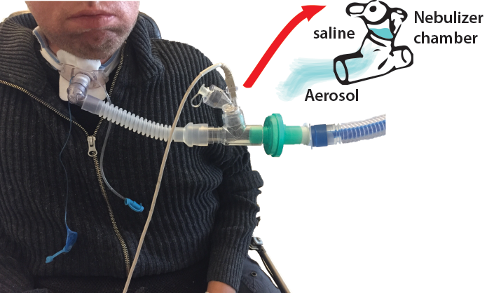 Patient and Nebulizer connection