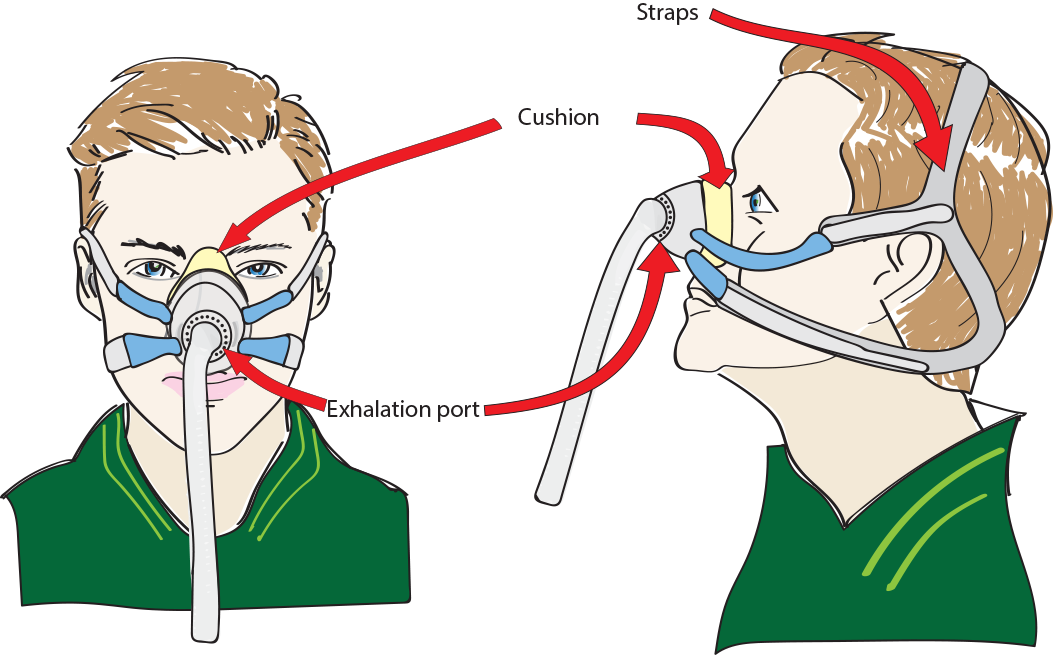 Person with nasal mask with descriptions